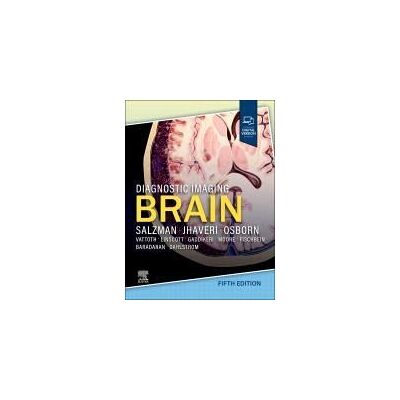 Elsevier Diagnostic Imaging: Brain Elsevier Diagnostic Imaging: Brain