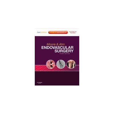 SAUNDERS W B CO Endovascular Surgery: Expert Consult - Online And Print, With Video SAUNDERS W B CO Endovascular Surgery: Expert Consult - Online And Print, With Video