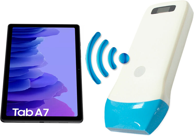 Ecógrafo portátil Sonostar: Doppler a color, sonda lineal de 10 MHz y función de asistencia a la punción + ¡Samsung Galaxy Tab A7 de regalo!