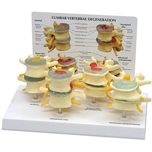 3B Scientific GPI Anatomicals Conjunto de modelo de vértebras, 4 fases 3B Scientific GPI Anatomicals Conjunto de modelo de vértebras, 4 fases
