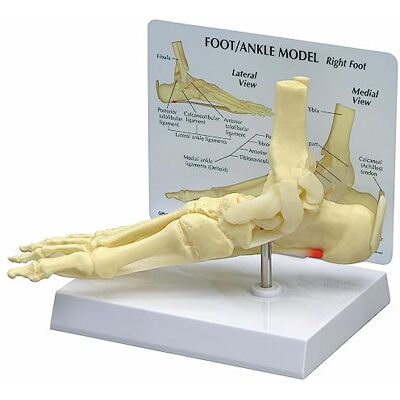 3B Scientific GPI Anatomicals Modelo de fascitis plantar, pie/tobillo 3B Scientific GPI Anatomicals Modelo de fascitis plantar, pie/tobillo