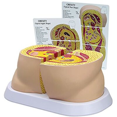3B Scientific GPI Anatomicals Modelo de obesidad 3B Scientific GPI Anatomicals Modelo de obesidad