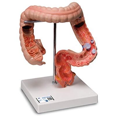 3B Scientific Modelo de anatomía humana racto intestinal 3B Scientific Modelo de anatomía humana racto intestinal