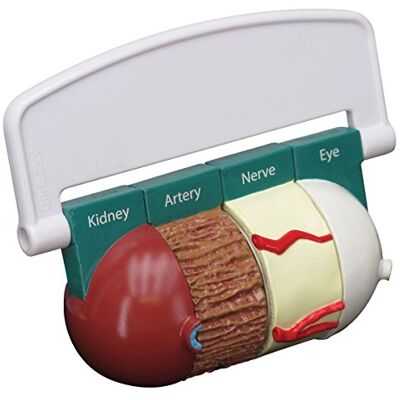 3B Scientific GPI Anatomicals Modelo de diabetes de 4 piezas 3B Scientific GPI Anatomicals Modelo de diabetes de 4 piezas