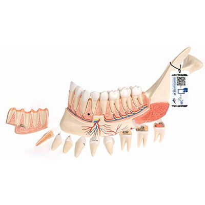 3B Scientific Modelo de anatomía humana ula inferior con 8 dientes cariados, 19 piezas + App de anatomía gratuita 3B Smart Anatomy 3B Scientific Modelo de anatomía humana ula inferior con 8 dientes cariados, 19 piezas + App de anatomía gratuita 3B Smart Anatomy