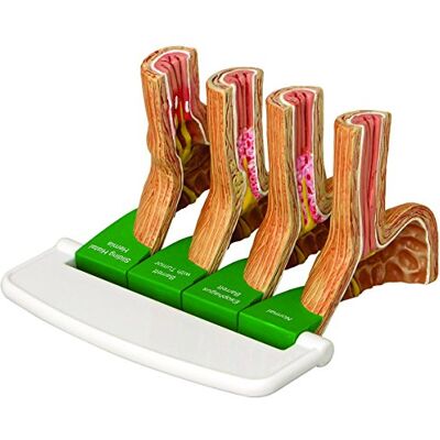 3B Scientific GPI Anatomicals Modelo de enfermedad por reflujo gastroesofágico (GERD), 4 piezas 3B Scientific GPI Anatomicals Modelo de enfermedad por reflujo gastroesofágico (GERD), 4 piezas