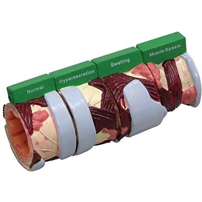 3B Scientific GPI Anatomicals Modelo de bronquio de 4 piezas 3B Scientific GPI Anatomicals Modelo de bronquio de 4 piezas