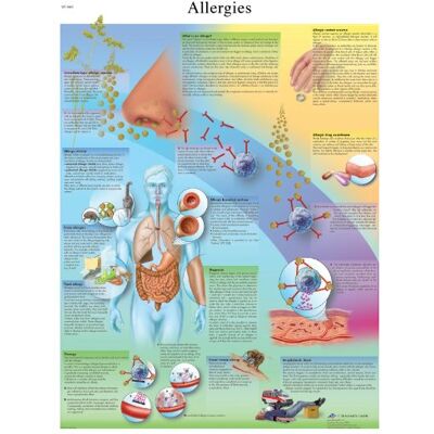 3B Scientific alergias gráfico, laminado, 1 3B Scientific alergias gráfico, laminado, 1