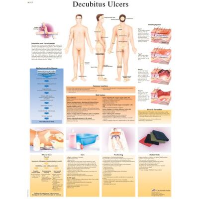 3B Scientific – Lámina Plastificada de las Úlceras por Decúbito – Póster de Patología Protegido contra UV y Polvo para Estudio, Enseñanza y Clínicas 3B Scientific – Lámina Plastificada de las Úlceras por Decúbito – Póster de Patología Protegido contra UV y Polvo para Estudio, Enseñanza y Clínicas