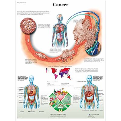 3B Scientific de cáncer de mama guía de posición de 3B Scientific de cáncer de mama guía de posición de