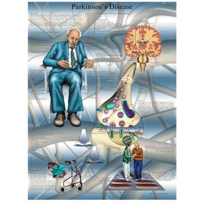 3B Scientific Tabla de enfermedades de Parkinsons Versión laminada 3B Scientific Tabla de enfermedades de Parkinsons Versión laminada