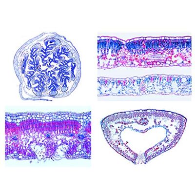 3B Scientific LIEDER Biología Microscopía Micro muestras Serien Flores Plantas (magnoli): tronco 3B Scientific LIEDER Biología Microscopía Micro muestras Serien Flores Plantas (magnoli): tronco