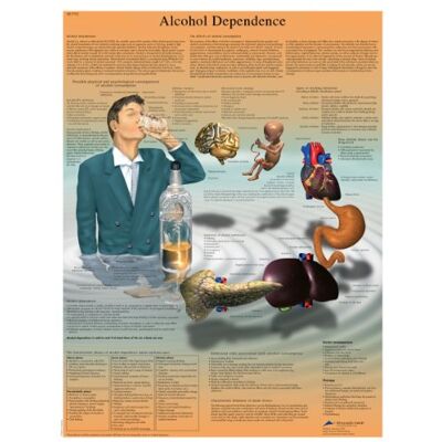 3B Scientific Alcohol Dependence gráfico, laminado, 1 3B Scientific Alcohol Dependence gráfico, laminado, 1
