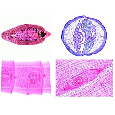 3B Scientific LIEDER Biología Microscopía Micro muestras Serien Tierchen Zapatillas (paramecium caudatum) 3B Scientific LIEDER Biología Microscopía Micro muestras Serien Tierchen Zapatillas (paramecium caudatum)