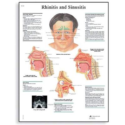 3B Scientific rinitis o Sinusitis guía de posición de 3B Scientific rinitis o Sinusitis guía de posición de