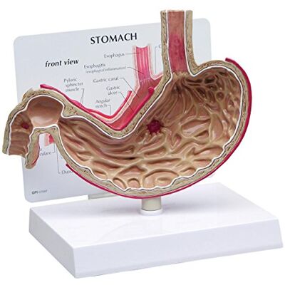 3B Scientific GPI Anatomicals Modelo de estómago con úlceras 3B Scientific GPI Anatomicals Modelo de estómago con úlceras