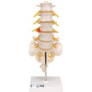 3B Scientific ® Modelo de Columna Lumbar – Vértebras Lumbares a Tamaño Real con Demostración de Hernia Discal Dorsolateral + Smart Anatomy App (Garantía de 5 Años) 3B Scientific ® Modelo de Columna Lumbar – Vértebras Lumbares a Tamaño Real con Demostración de Hernia Discal Dorsolateral + Smart Anatomy App (Garantía de 5 Años)