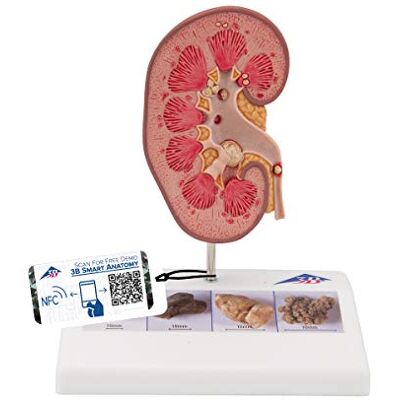 3B Scientific K29 Modelo de anatomía humana Modelo de Cálculo Renal + App de anatomía gratuita 3B Smart Anatomy 3B Scientific K29 Modelo de anatomía humana Modelo de Cálculo Renal + App de anatomía gratuita 3B Smart Anatomy