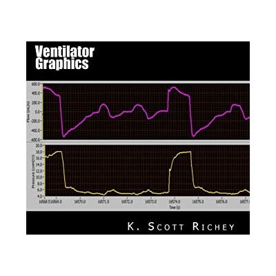 Scott Ventilator Graphics: Identifying Patient Ventilator Asynchrony and Optimizing Settings Scott Ventilator Graphics: Identifying Patient Ventilator Asynchrony and Optimizing Settings
