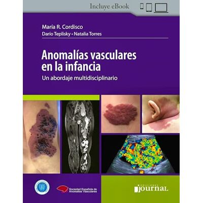 MARIA R CORDISCO ANOMALIAS VASCULARES EN LA INFANCIA MARIA R CORDISCO ANOMALIAS VASCULARES EN LA INFANCIA