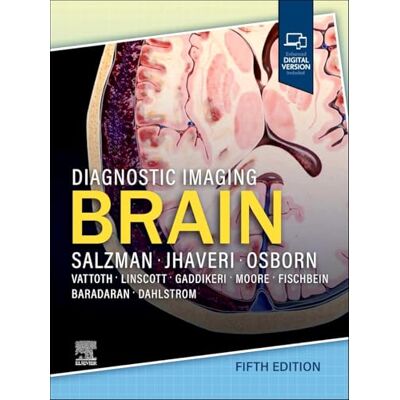 Karen L. Salzman MD FACR Diagnostic Imaging: Brain, Karen L. Salzman MD FACR Diagnostic Imaging: Brain,