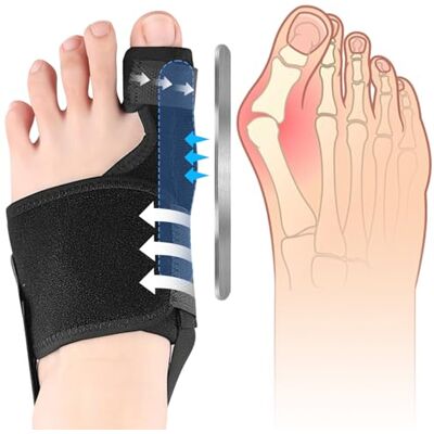 Viexpand Bunion Corrector, Adjustable Toe Separators, Hallux Valgus and Super Toes, Heel Adjustment Straps, Suitable for Men and Women Feet, Day and Night (Left) Viexpand Bunion Corrector, Adjustable Toe Separators, Hallux Valgus and Super Toes, Heel Adjustment Straps, Suitable for Men and Women Feet, Day and Night (Left)