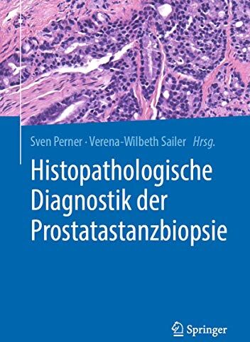 Sven Perner Hisathologische Diagnostik Der Prostatastanzbiopsie