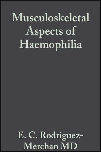 Rodriguez-Merchan, E. C. Musculoskeletal Aspects Of Haemophilia