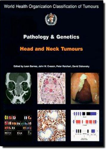 The International Agency for Research on Pathology And Genetics Of Head And Neck Tumours (Who Classification Of Tumours)