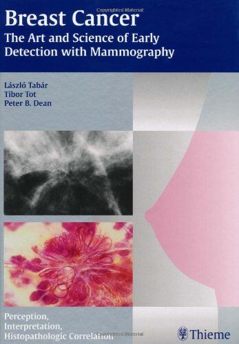 Laszlo Tabar Breast Cancer - The Art And Science Of Early Detection With Mammography: Perception, Interpretation, Hisathologic Correlation