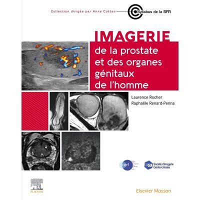 Laurence Rocher Imagerie De La Prostate Et Des Organes Génitaux De L'Homme - Publicité Laurence Rocher Imagerie De La Prostate Et Des Organes Génitaux De L'Homme - Publicité