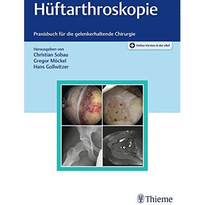 Christian Sobau Hüftarthroskopie: Praxisbuch Für Die Gelenkerhaltende Chirurgie - Publicité Christian Sobau Hüftarthroskopie: Praxisbuch Für Die Gelenkerhaltende Chirurgie - Publicité