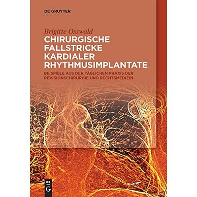 Brigitte Osswald Chirurgische Fallstricke Kardialer Rhythmusimplantate: Beispiele Aus Der Täglichen Praxis Der Revisionschirurgie Und Rechtsmedizin - Publicité Brigitte Osswald Chirurgische Fallstricke Kardialer Rhythmusimplantate: Beispiele Aus Der Täglichen Praxis Der Revisionschirurgie Und Rechtsmedizin - Publicité