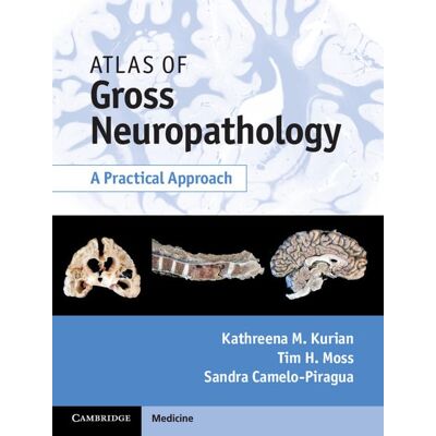 Kurian, Kathreena M. Atlas Of Gross Neuropathology Book And Online Bundle: A Practical Approach - Publicité Kurian, Kathreena M. Atlas Of Gross Neuropathology Book And Online Bundle: A Practical Approach - Publicité