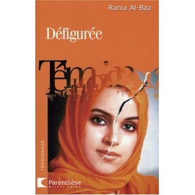 Rania Al-Baz Défigurée : Quand Un Crime Passionnel Devient Affaire D'Etat - Publicité Rania Al-Baz Défigurée : Quand Un Crime Passionnel Devient Affaire D'Etat - Publicité
