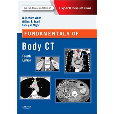 Webb, W. Richard Fundamentals Of Body Ct: Expert Consult - Online And Print (Fundamentals Of Radiology) - Publicité Webb, W. Richard Fundamentals Of Body Ct: Expert Consult - Online And Print (Fundamentals Of Radiology) - Publicité