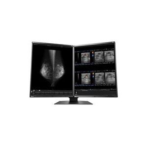 Eizo RadiForce RX560-MD - ecran LED - 5MP - couleur - 21.3 - Publicité Eizo RadiForce RX560-MD - ecran LED - 5MP - couleur - 21.3 - Publicité