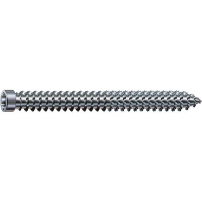 Vis pour cadre en bois SPAX FRANCE - Torx - Ø7,5x60mm - Tête fraisée plate - Filet complet - Pack de 100 - Publicité Vis pour cadre en bois SPAX FRANCE - Torx - Ø7,5x60mm - Tête fraisée plate - Filet complet - Pack de 100 - Publicité