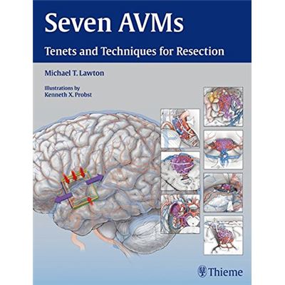 Thieme Medical Publishers Seven Avms: Tenets And Techniques For Resection - Publicité Thieme Medical Publishers Seven Avms: Tenets And Techniques For Resection - Publicité