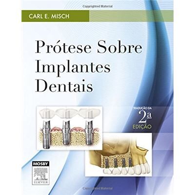 Elsevier Prótese Sobre Implantes Dentais - Publicité Elsevier Prótese Sobre Implantes Dentais - Publicité