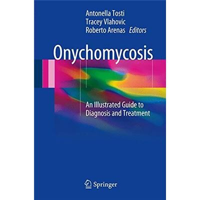 Springer Onychomycosis: An Illustrated Guide To Diagnosis And Treatment - Publicité Springer Onychomycosis: An Illustrated Guide To Diagnosis And Treatment - Publicité