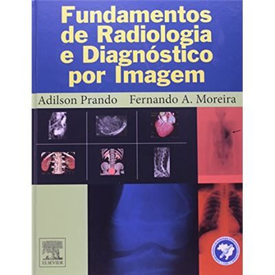 Elsevier Fundamentos De Radiologia E Diagnóstico Por Imagem - Publicité Elsevier Fundamentos De Radiologia E Diagnóstico Por Imagem - Publicité