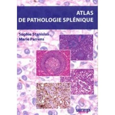 Atlas de pathologie splenique - Sophie Stanislas - Sauramps Medical - broché - Scolaire / Universitaire - Publicité Atlas de pathologie splenique - Sophie Stanislas - Sauramps Medical - broché - Scolaire / Universitaire - Publicité