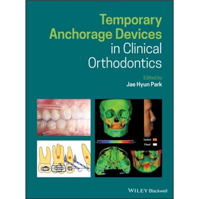John Wiley and Sons Ltd Temporary Anchorage Devices in Clinical Orthodontics - Publicité John Wiley and Sons Ltd Temporary Anchorage Devices in Clinical Orthodontics - Publicité
