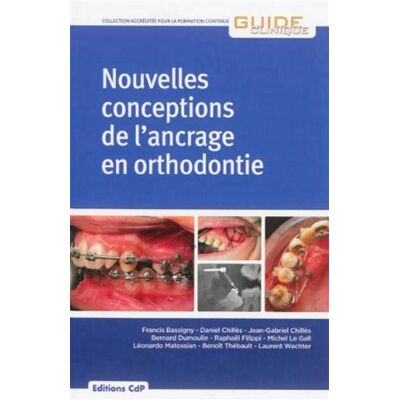 Nouvelles conceptions de l'ancrage en orthodontie - Francis Bassigny - Cdp - broché - Manuel - Publicité Nouvelles conceptions de l'ancrage en orthodontie - Francis Bassigny - Cdp - broché - Manuel - Publicité