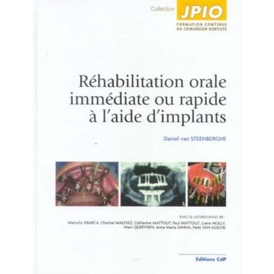 Réhabilitation orale immédiate ou rapide à l'aide d'implants - Daniel van Steenberghe - Cdp - broché - Scolaire / Universitaire - Publicité Réhabilitation orale immédiate ou rapide à l'aide d'implants - Daniel van Steenberghe - Cdp - broché - Scolaire / Universitaire - Publicité