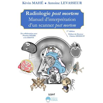 Radiologie post mortem Manuel d'interprétation d'un scanner post mortem - Kevin Mahé - Eska - broché - Scolaire / Universitaire - Publicité Radiologie post mortem Manuel d'interprétation d'un scanner post mortem - Kevin Mahé - Eska - broché - Scolaire / Universitaire - Publicité