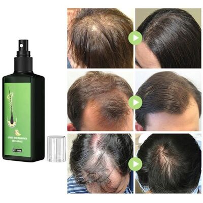 Sérum de croissance des cheveux - OMABETA - Gingembre - 100 ml - Tous types de cheveux - Anti-chute - Publicité Sérum de croissance des cheveux - OMABETA - Gingembre - 100 ml - Tous types de cheveux - Anti-chute - Publicité