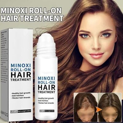 AUTREMENT 5pcs ScalpRevive Minoxidil Growth RollerMinoxi Roll-on Hair TreatmentPromote Hair GrowthHair Growth Serum Gel Roll TRAITEMENT - Publicité AUTREMENT 5pcs ScalpRevive Minoxidil Growth RollerMinoxi Roll-on Hair TreatmentPromote Hair GrowthHair Growth Serum Gel Roll TRAITEMENT - Publicité