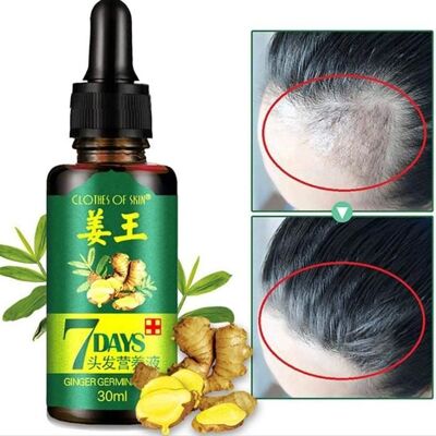Anti Chute Cheveux Sérum de Croissance des Cheveux Naturel à Base de Plantes sérum de Pousse Cheveux Aidez à la Pousse des - Publicité Anti Chute Cheveux Sérum de Croissance des Cheveux Naturel à Base de Plantes sérum de Pousse Cheveux Aidez à la Pousse des - Publicité